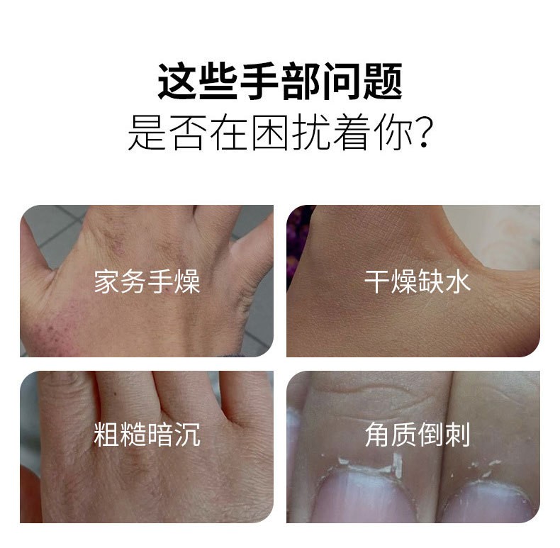 护手霜帮您解决手部以下问题 护手霜帮您解决手部以下问题
