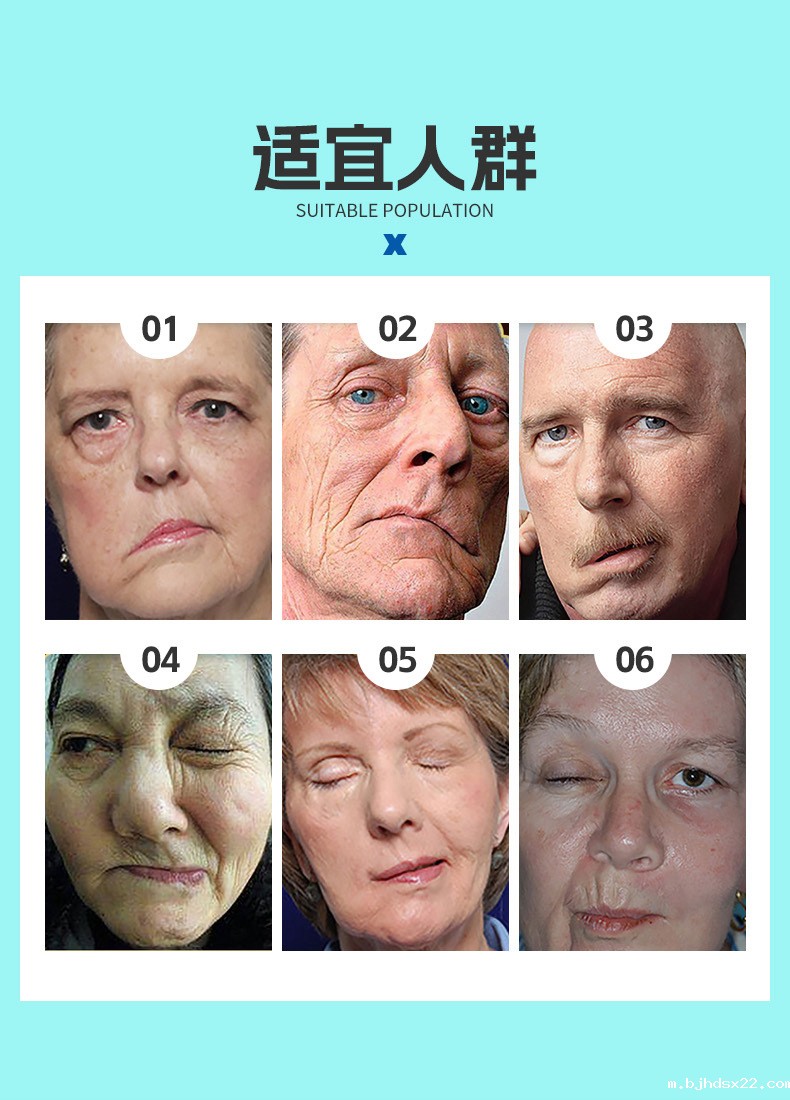 面瘫贴适宜人群 面瘫贴适宜人群